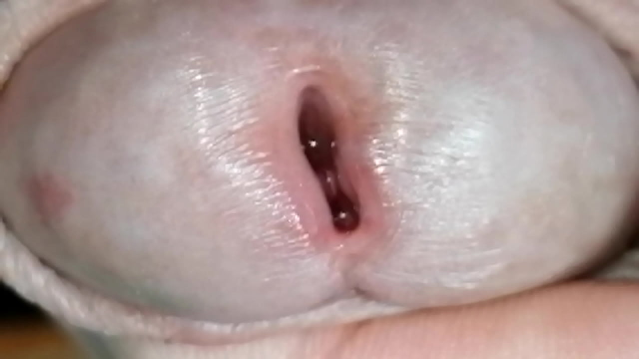 Zils M. reccomend urethral penis fuck trembling orgasm